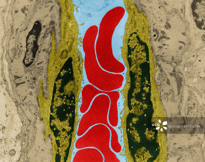 毛细血管中的红细胞（透射电镜）图片素材