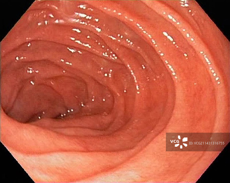 健康的十二指肠内窥镜视图图片素材