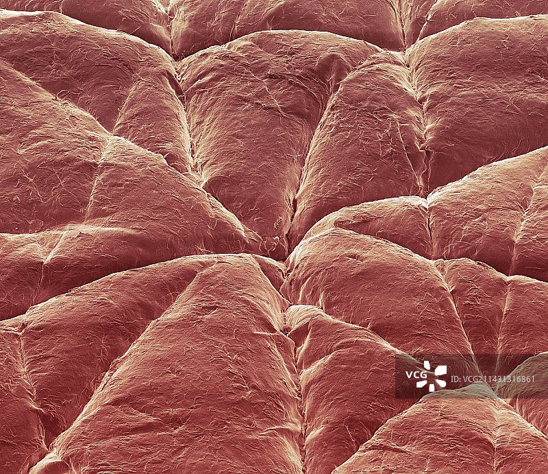 皮肤表面扫描电镜图图片素材