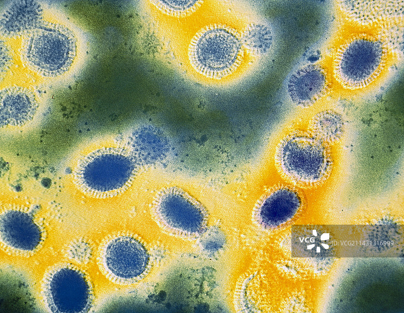 流感病毒颗粒的彩色透射电镜图像图片素材