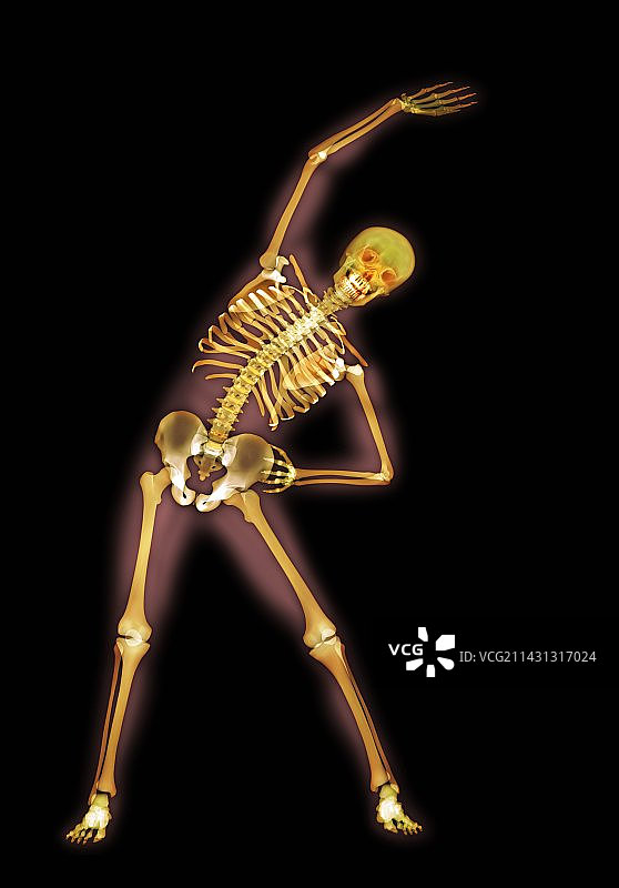 侧弯，X光艺术作品图片素材