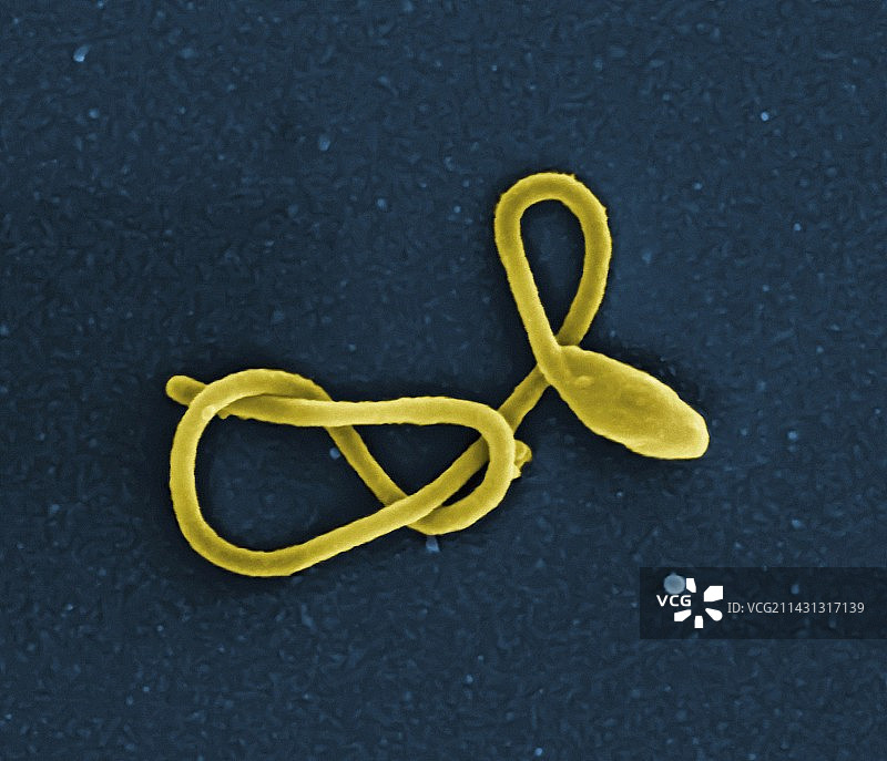 埃博拉病毒颗粒扫描电镜图图片素材