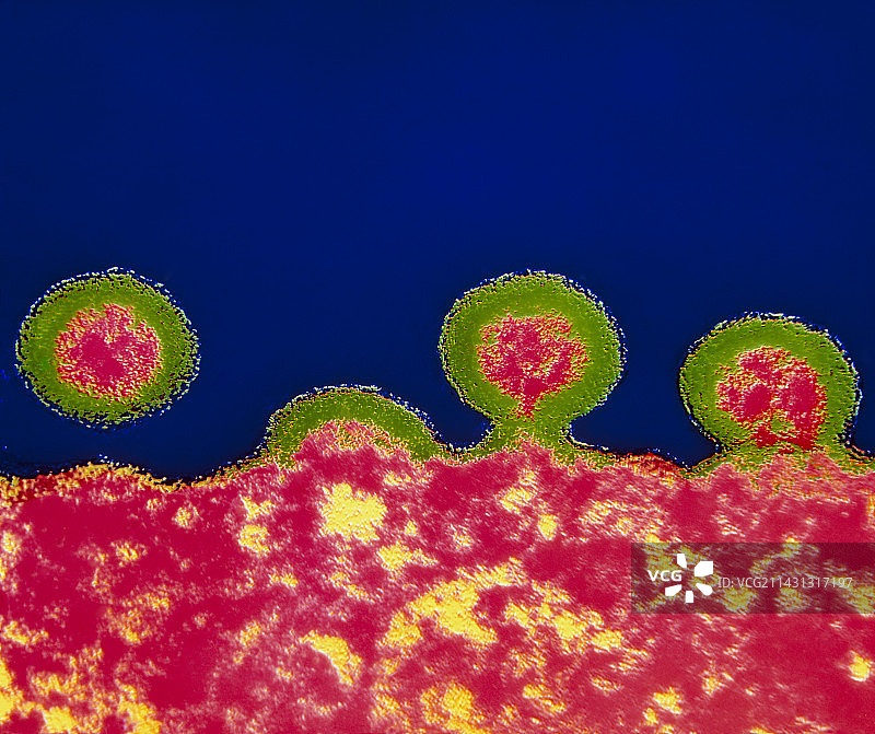 T细胞出芽的HIV病毒彩色透射电镜图图片素材