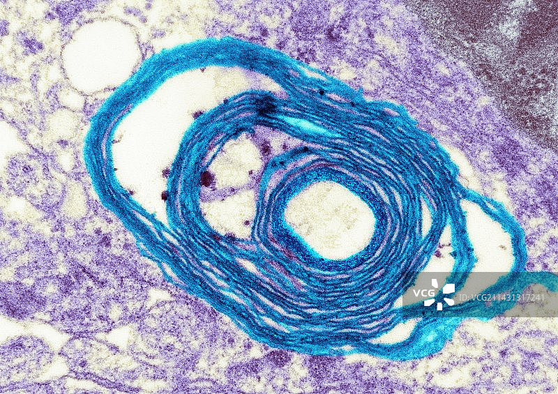 神经轴突周围的髓磷脂，透射电子显微镜图片素材