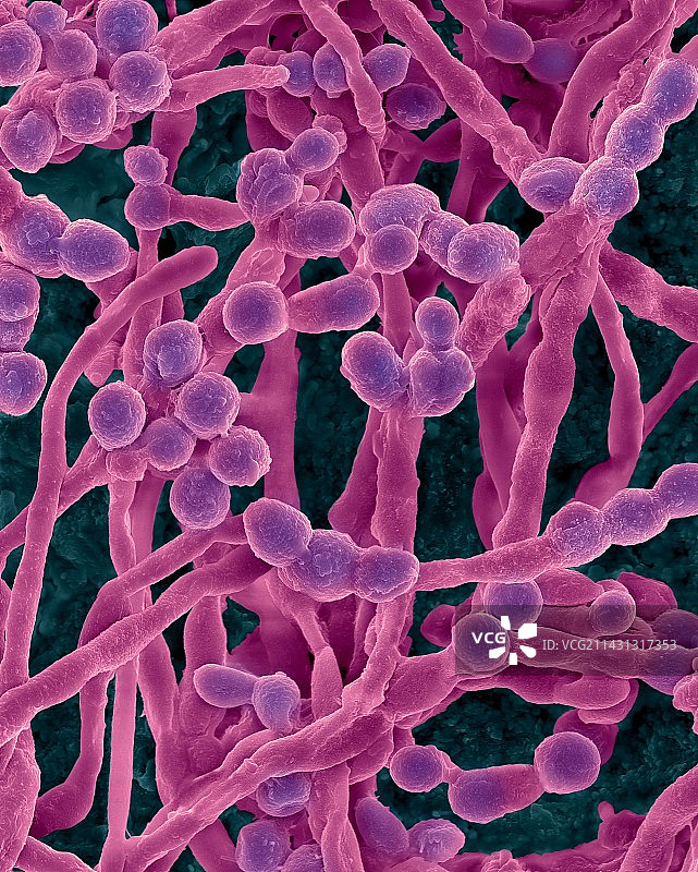 霉菌（枝孢菌属）菌丝和孢子，扫描电镜图片素材