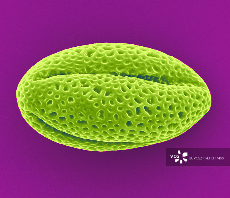 油菜花粉扫描电镜图图片素材