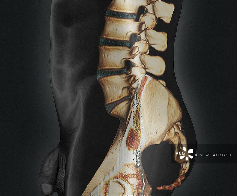 正常下脊柱CT扫描图片素材