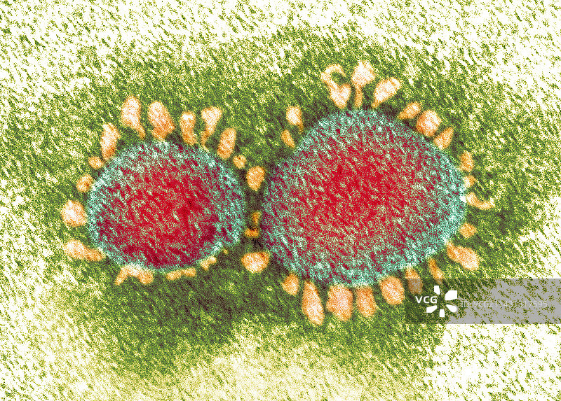 新冠病毒TEM图图片素材
