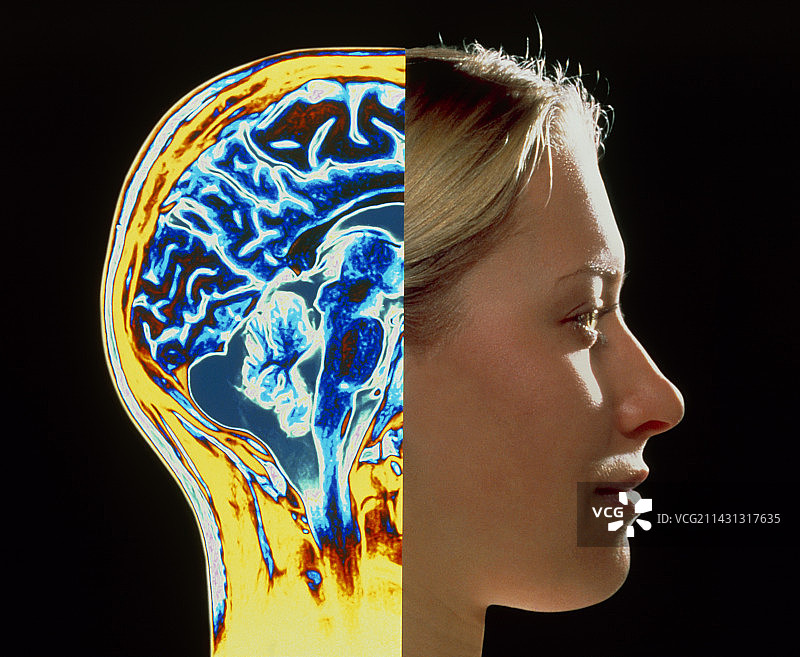 叠加在头部上的彩色脑部MRI扫描图片素材