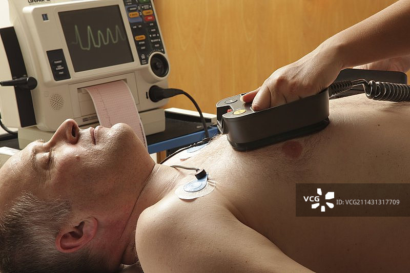 心脏病发作患者的复苏图片素材