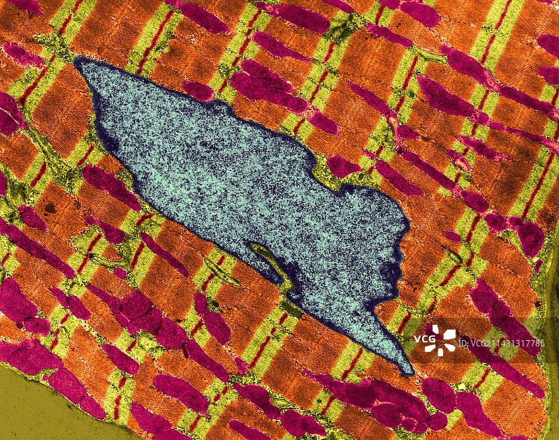 心肌细胞透射电镜图图片素材