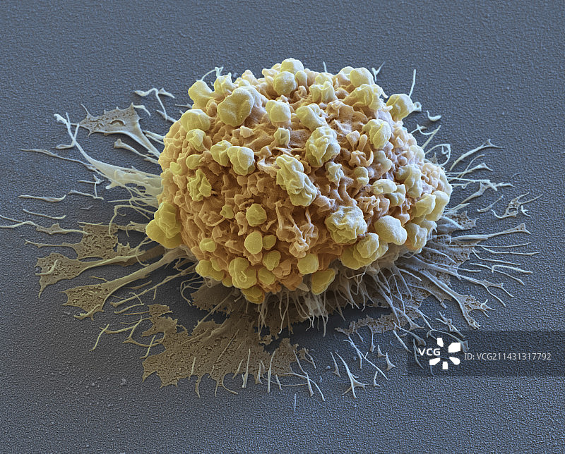 细胞凋亡扫描电镜图图片素材