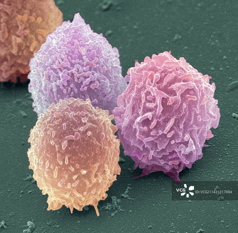 白细胞扫描电镜图图片素材