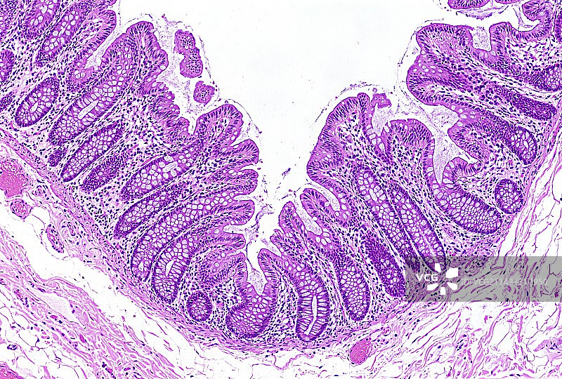 结肠浅显微照片图片素材