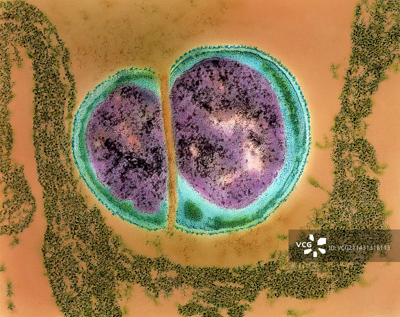 异球菌图片素材