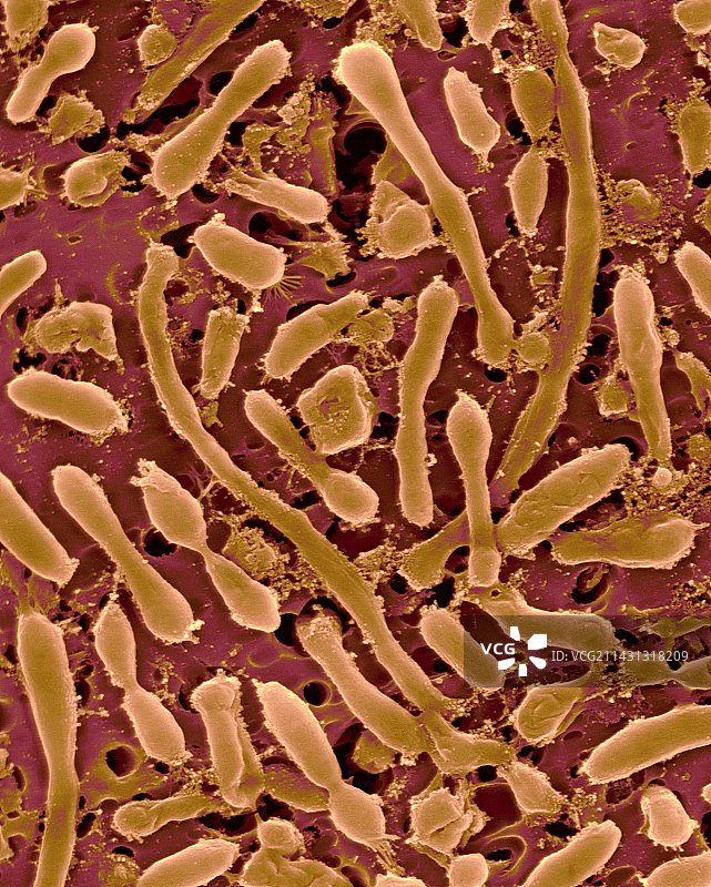 嗜盐古菌扫描电镜图图片素材