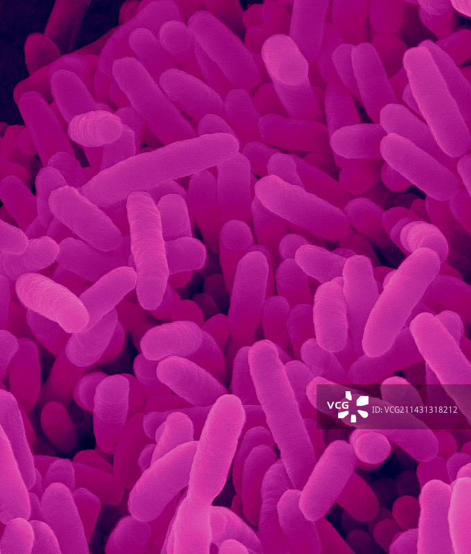 脆弱拟杆菌扫描电镜图图片素材