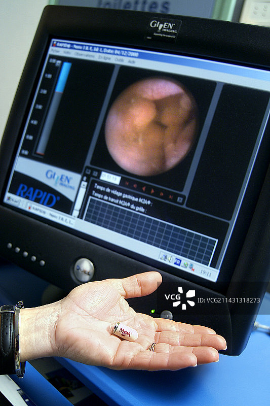 胶囊内窥镜图片素材