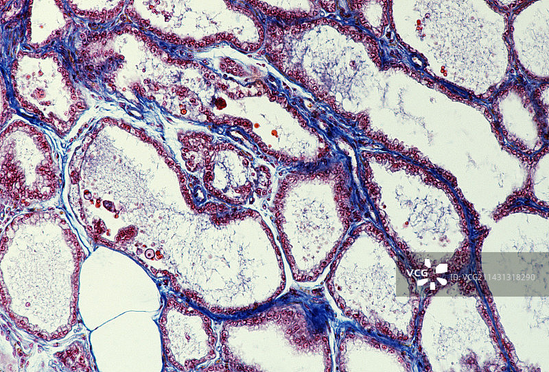 哺乳期乳腺组织图片素材