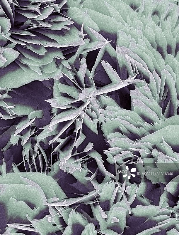 肾结石晶体扫描电镜图图片素材