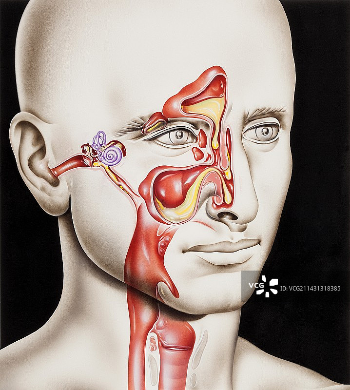 上呼吸道感染图片素材