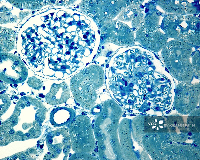 肾小球显微照片图片素材