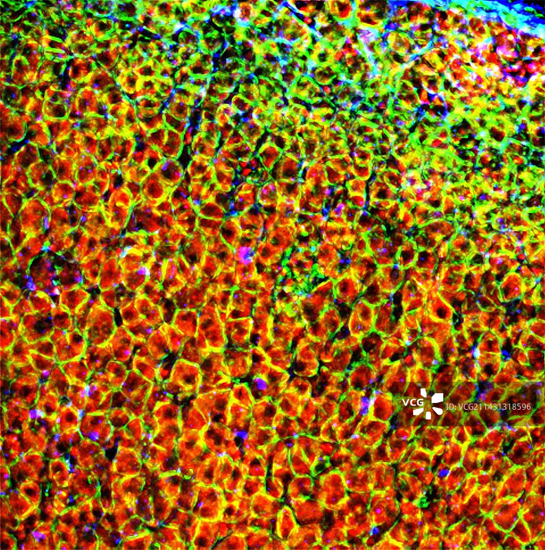 肾上腺荧光显微照片图片素材