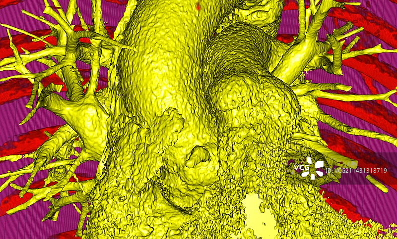 主动脉和肺动脉3D CT扫描图片素材