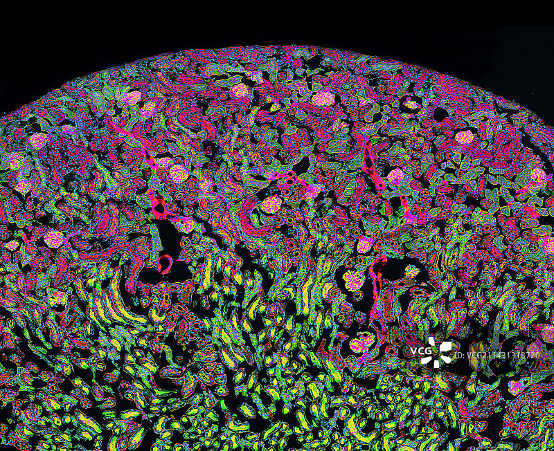 肾脏，共聚焦显微照片图片素材