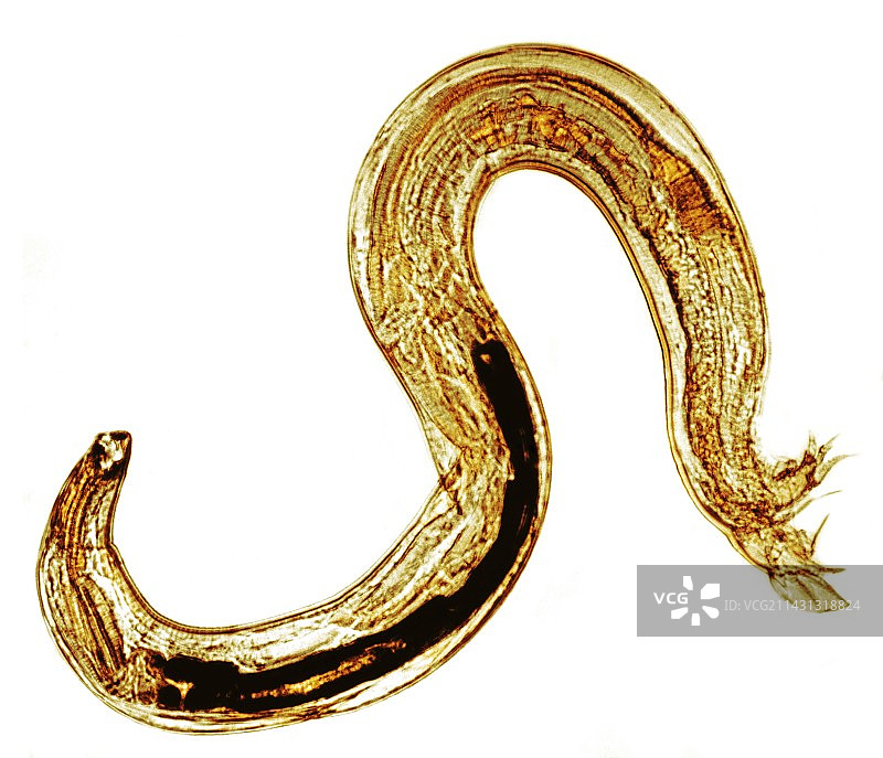 旧世界的钩虫显微照片图片素材