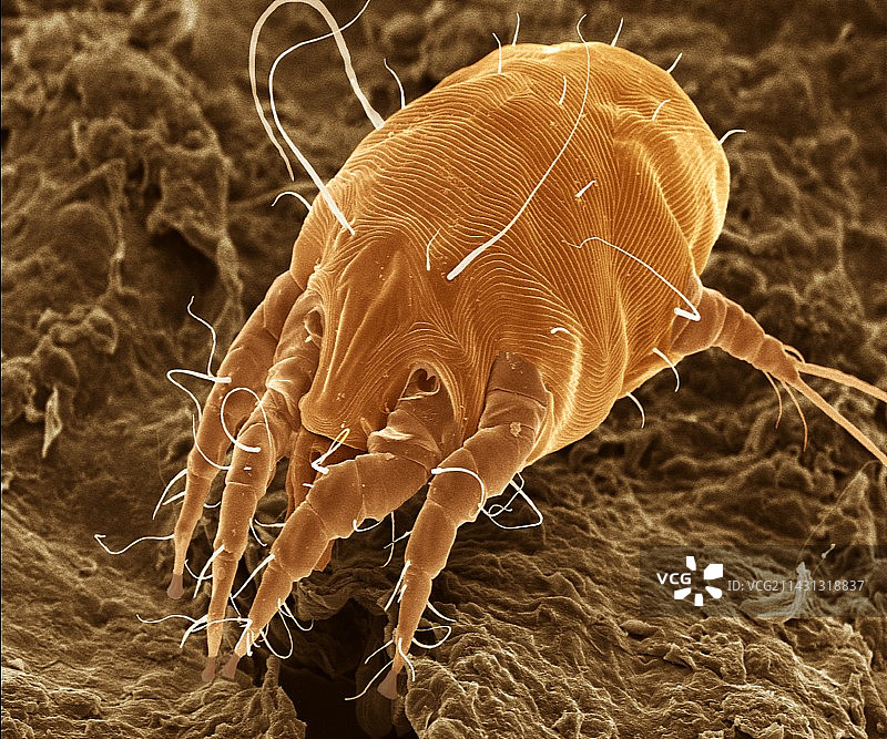 耳螨图片素材