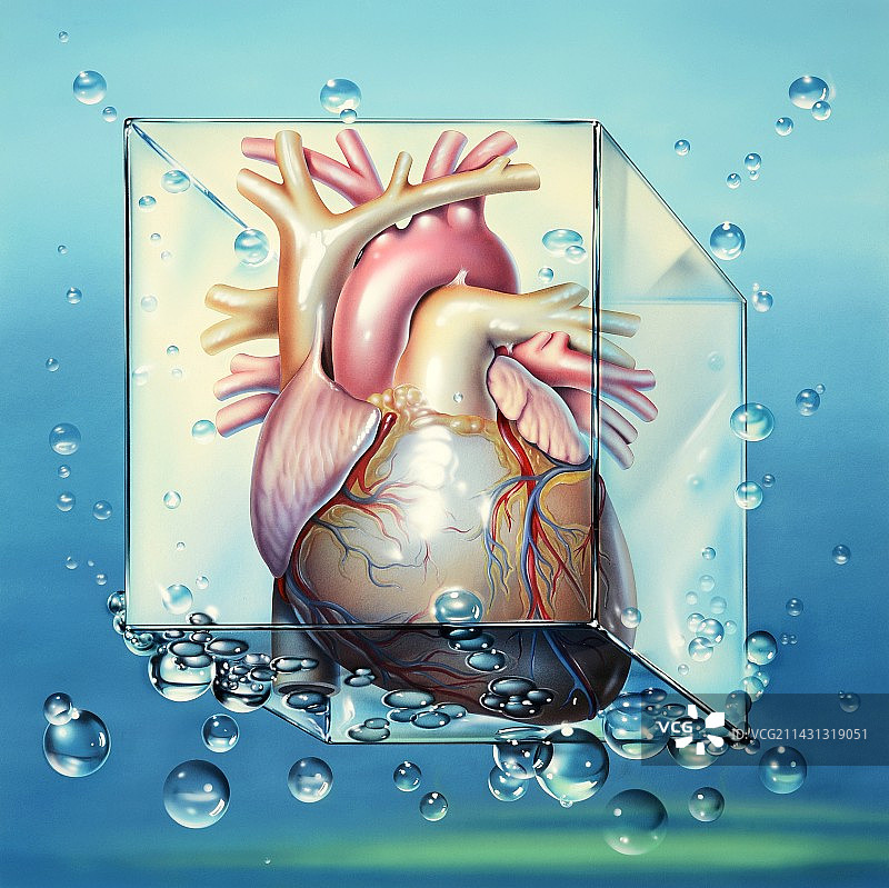 心源性休克医疗插画图片素材