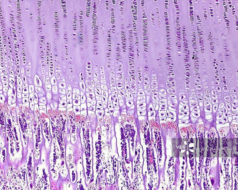 软骨内骨化，光学显微照片图片素材