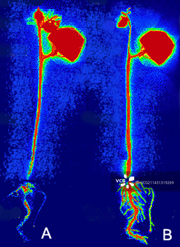 植物对昆虫攻击的反应,PET扫描图片素材