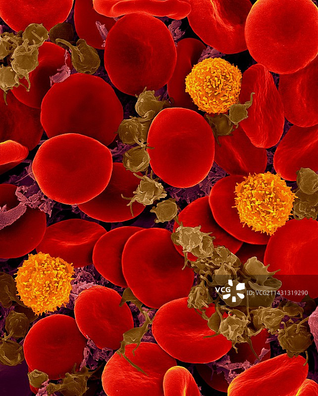 红细胞、T淋巴细胞和活化血小板，扫描电镜图片素材