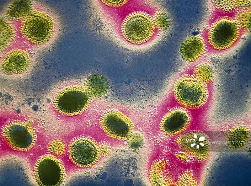 流感病毒的透射电子显微镜图像图片素材