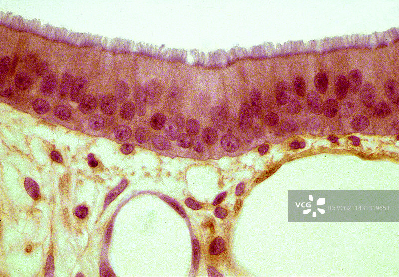 气管上皮细胞显微照片图片素材