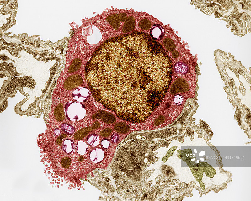 肺泡细胞，透射电镜图片素材