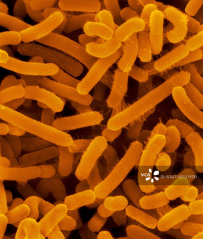 根癌农杆菌，扫描电子显微镜图片素材