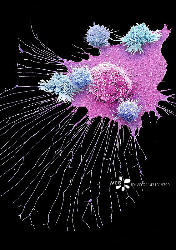 CAR T细胞疗法，扫描电镜图片素材