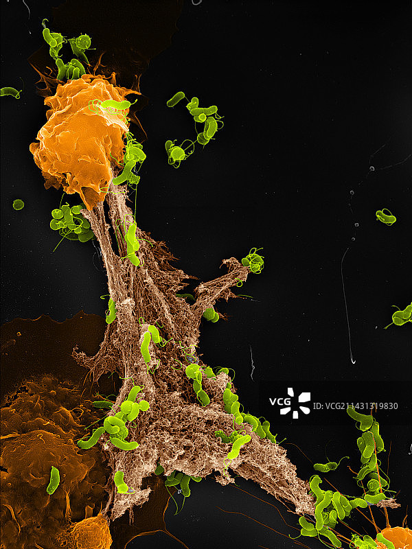 中性粒细胞胞外诱捕网扫描电镜图图片素材