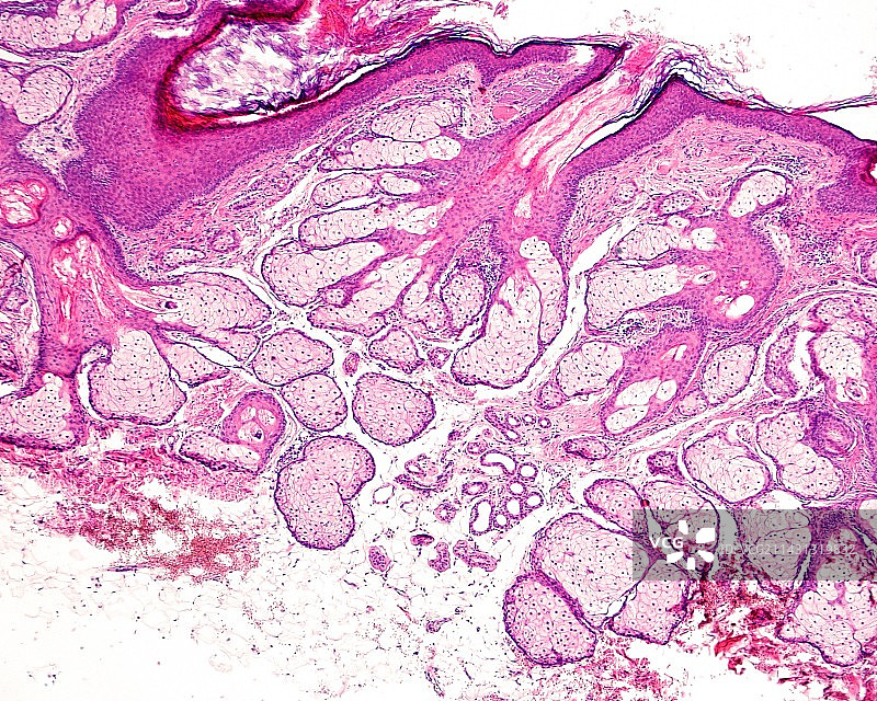 皮脂腺显微照片图片素材