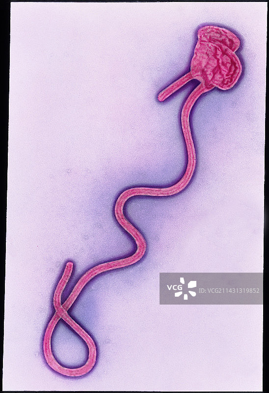 埃博拉病毒的彩色透射电镜图图片素材