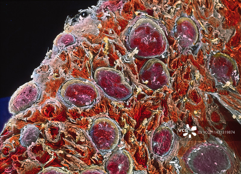 舌头乳突扫描电镜图图片素材