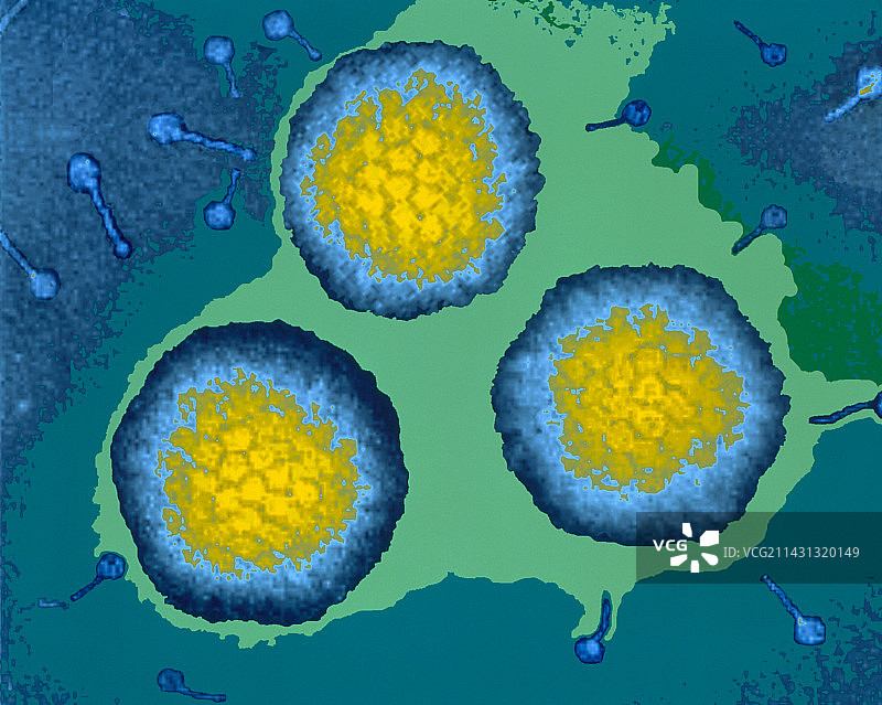 三种腺病毒的彩色透射电镜图图片素材