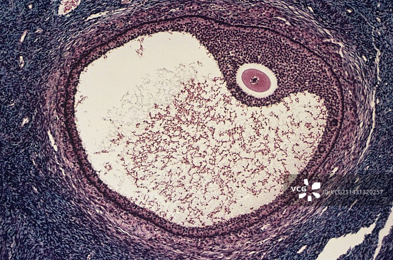 卵巢卵泡显微照片图片素材