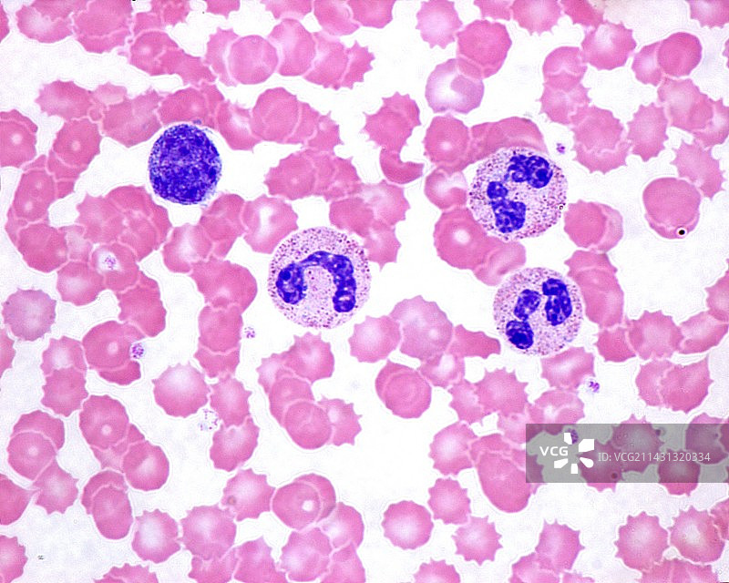 血涂片，光学显微照片图片素材
