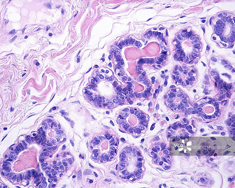 人乳腺光学显微照片图片素材