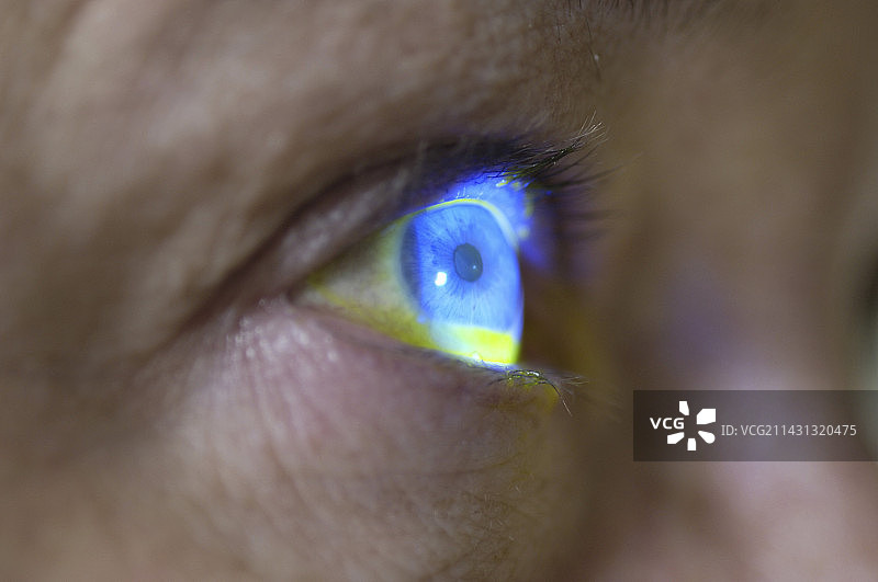 测量眼压图片素材