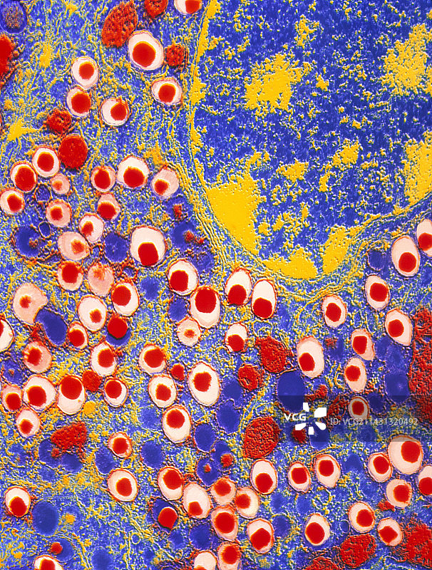 Langerhans细胞岛的透射电镜图图片素材